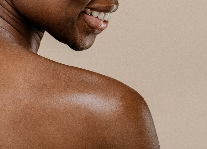Close-up of woman's shoulder skin